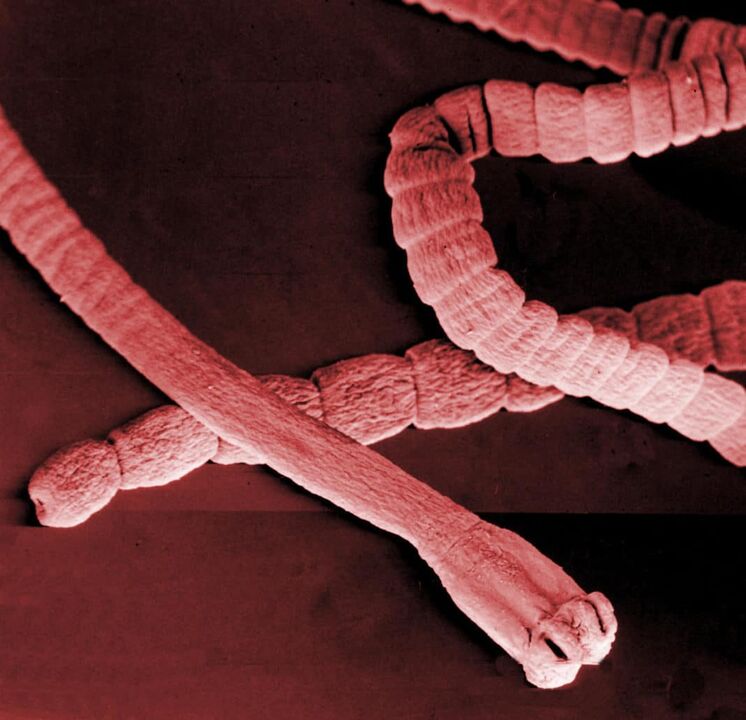 kaiseworm